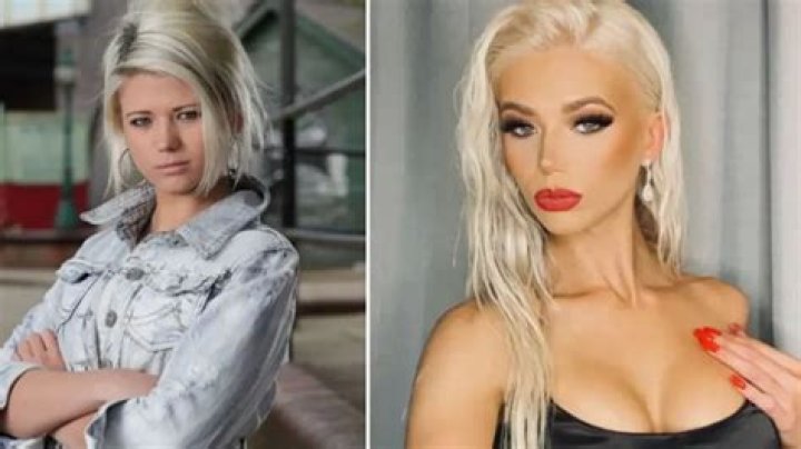 Boob Jobs, Lip Fillers, And Nose Jobs!