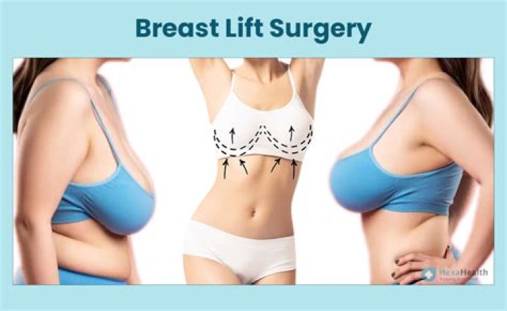 Breast Augmentation, Laser Treatment & More!