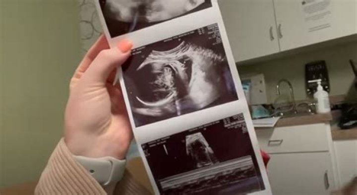 Counting On Alum Joy-Anna Forsyth Updates At 33 Weeks Pregnant