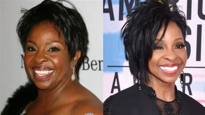 Did Gladys Knight Undergo Weight Loss Surgery?