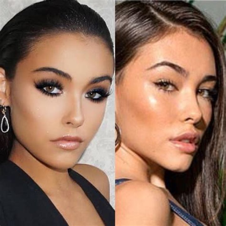 Did Madison Beer Have Breast Implants? Lip Fillers And Other Plastic Surgery Details!