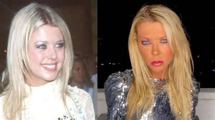 Tara Reid’s Bad Plastic Surgery: Her Appearance Now!
