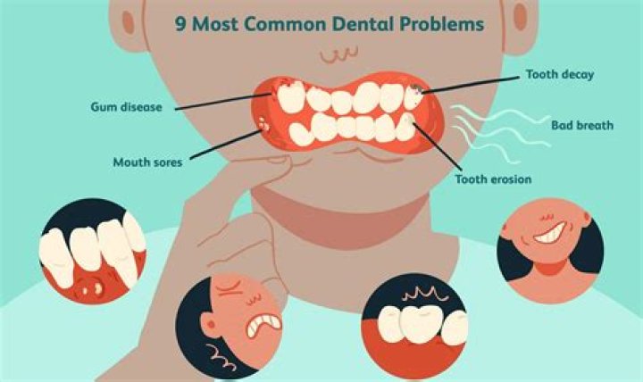 Were They Bad? Dental Problems!